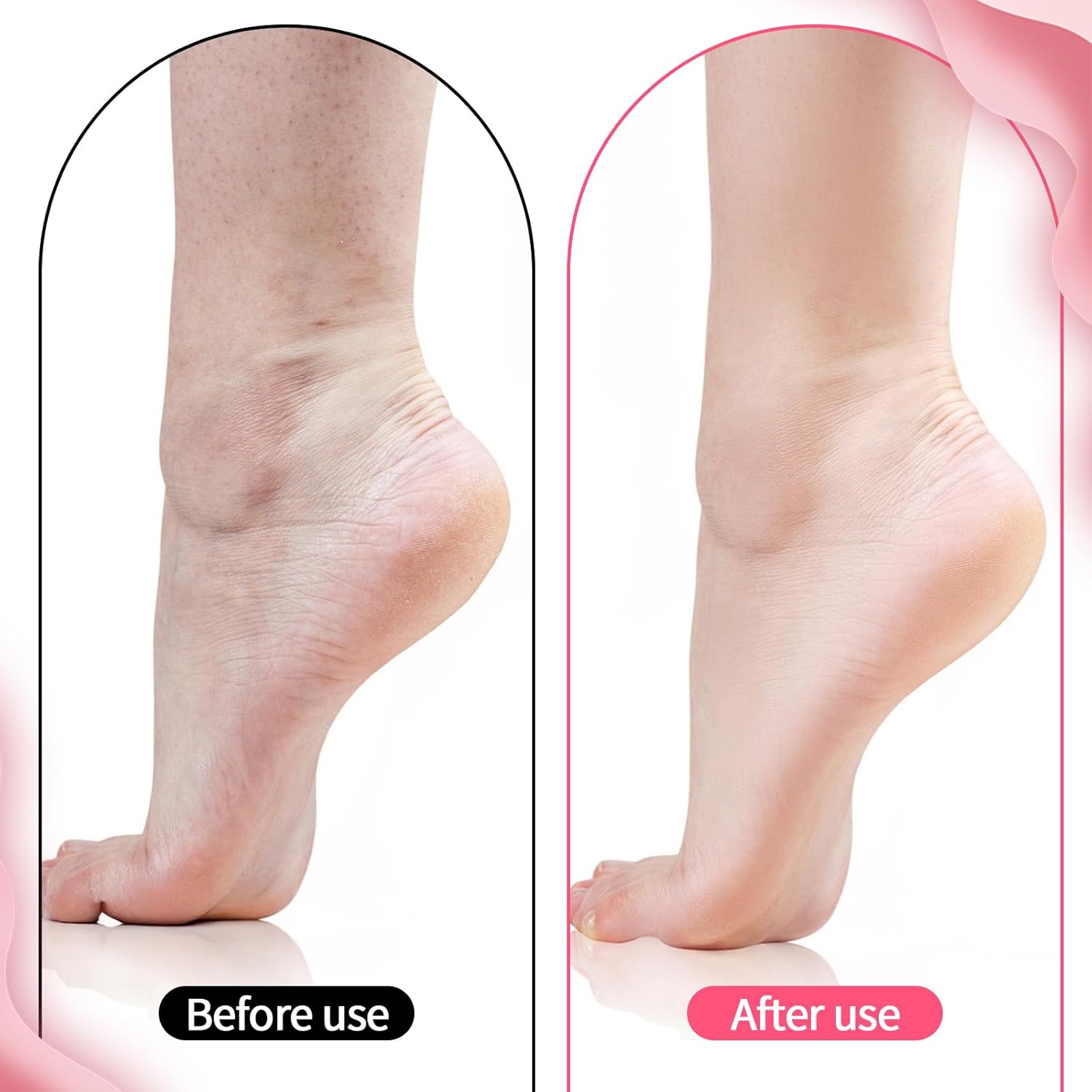 Reusable moisturizing socks for healthy-looking feet