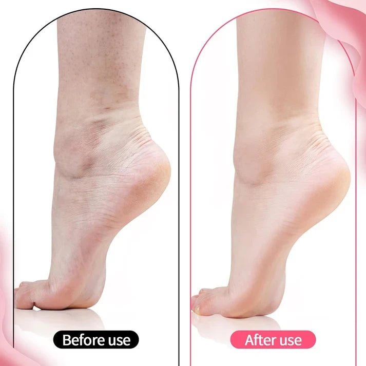 🧦 Premium Silicone Moisturizing Gel Socks – Reusable Heel Repair & Dry Foot Treatment