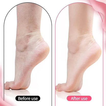🧦 Premium Silicone Moisturizing Gel Socks – Reusable Heel Repair & Dry Foot Treatment